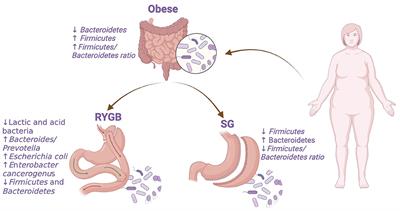 Microbiota dynamics preceding bariatric surgery as obesity treatment: a comprehensive review